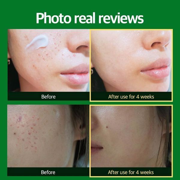 Заспокійливий протизапальний крем W-Skin Cica +Reparir Cream 50 мл ws0011 фото